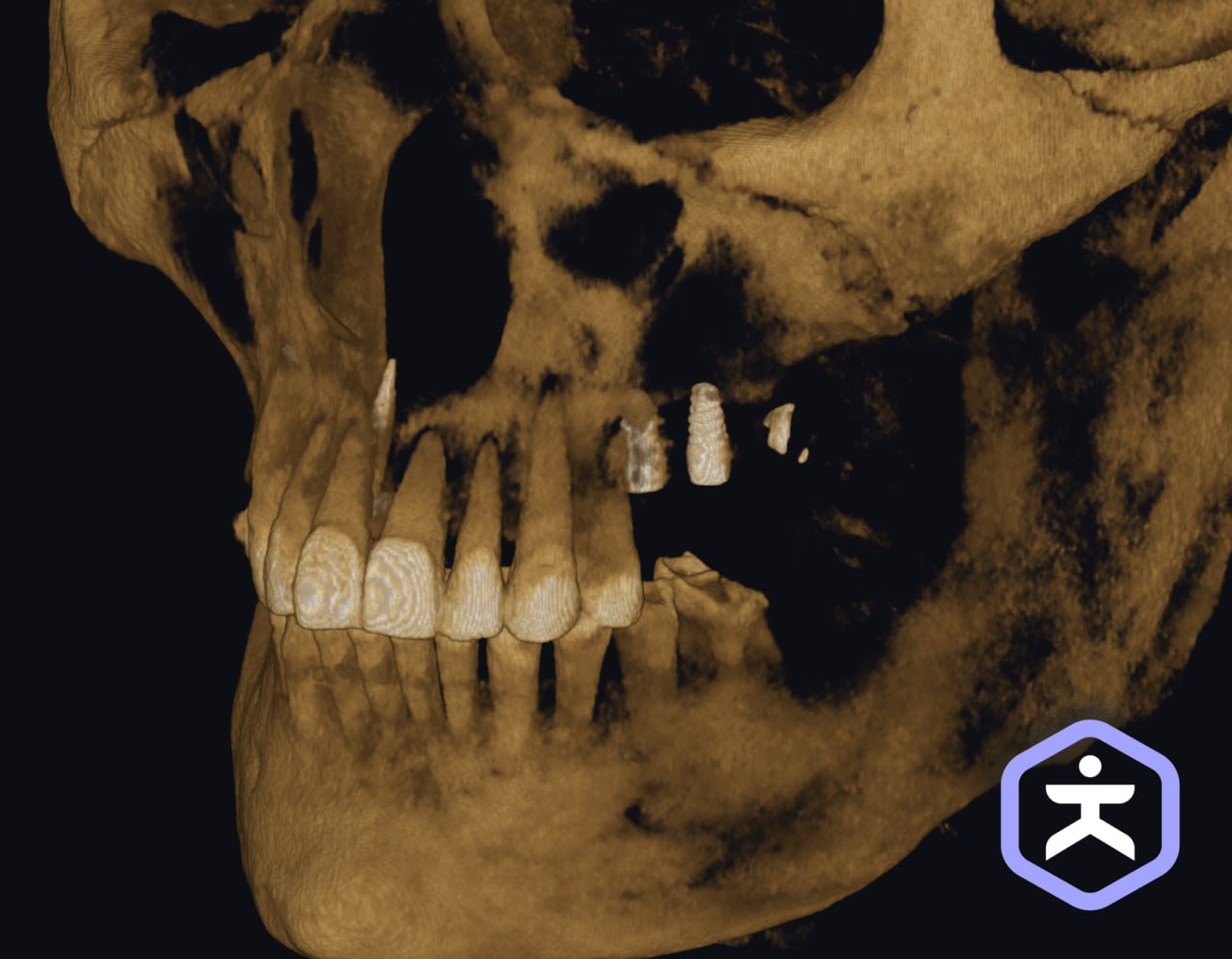 3D dental CBCT scan visualization of jaw and teeth