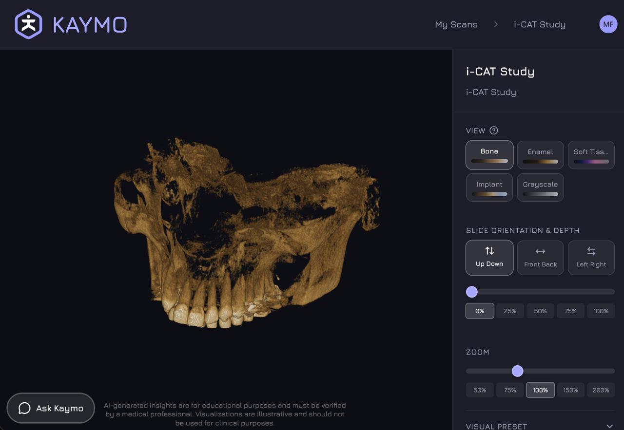KAYMO dental CBCT viewer showing 3D jaw visualization with colormap controls