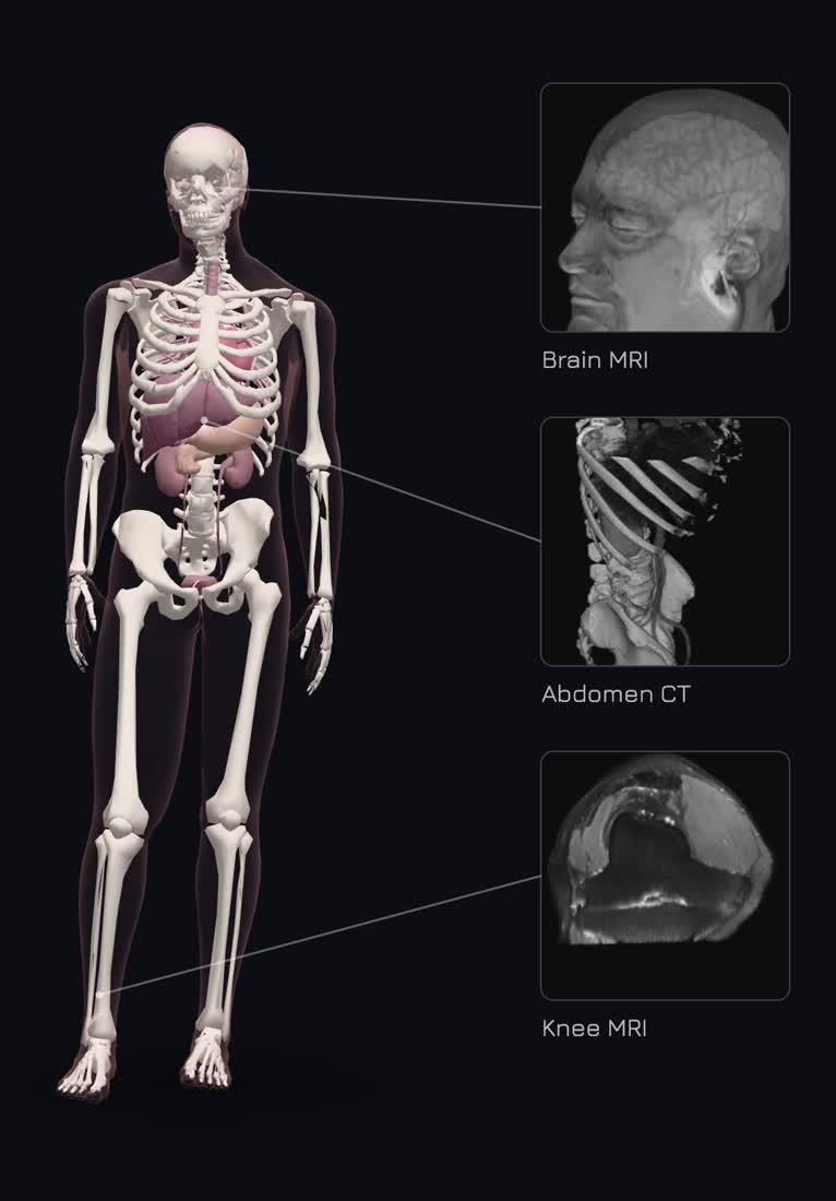 A 3D body with each scan pinned where it was taken